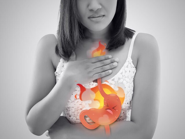 Πώς η Διατροφή Επηρεάζει τη Γαστροοισοφαγική Παλινδρόμηση – Ο Πλήρης Οδηγός