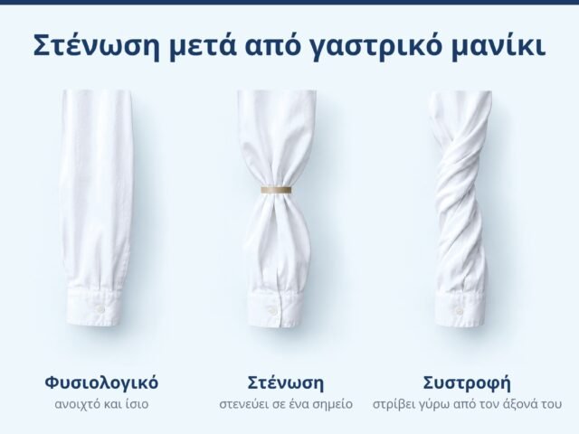 Στένωση μετά από γαστρικό μανίκι: συμπτώματα, διάγνωση και λύσεις