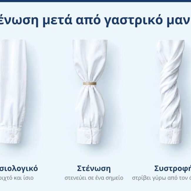 Τρία μανίκια πουκαμίσου, φυσιολογικό, σφιγμένο σε ένα σημείο και στριμμένο, ως αναλογία για τη στένωση και τη συστροφή μετά από γαστρικό μανίκι